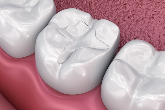 Woman in jacket leaning back in dental chair